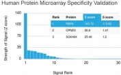 Analysis of HuProt(TM) microarray containing more than 19,000 full-length human proteins using RBP4 antibody. These results demonstrate the foremost specificity of the RBP4/4043 mAb. Z- and S- score: The Z-score represents the strength of a signal that an antibody (in combination with a fluorescently-tagged anti-IgG secondary Ab) produces when binding to a particular protein on the HuProt(TM) array. Z-scores are described in units of standard deviations (SD's) above the mean value of all signals generated on that array. If the targets on the HuProt(TM) are arranged in descending order of the Z-score, the S-score is the difference (also in units of SD's) between the Z-scores. The S-score therefore represents the relative target specificity of an Ab to its intended target.