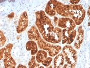 IHC staining of FFPE human kidney with RBP4 antibody. HIER: boil tissue sections in pH 9 10mM Tris with 1mM EDTA for 20 min and allow to cool before testing.