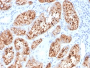 IHC staining of FFPE human kidney with RBP4 antibody. HIER: boil tissue sections in pH 9 10mM Tris with 1mM EDTA for 20 min and allow to cool before testing.