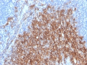 IHC staining of FFPE human small intestine with recombinant Syndecan-1 antibody (clone SDC1/4378R). HIER: boil tissue sections in pH 9 10mM Tris with 1mM EDTA for 20 min and allow to cool before testing.