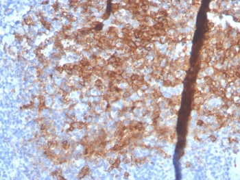 IHC staining of FFPE human small intestine with recombinant Syndecan-1 antibody (clone SDC1/4378R). HIER: boil tissue sections in pH 9 10mM Tris with 1mM EDTA for 20 min and allow to cool before testing.~