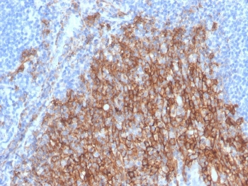 IHC staining of FFPE human small