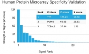 Analysis of HuProt(TM) microarray containing more than 19,000 full-length human proteins using TTR antibody. These results demonstrate the foremost specificity of the TTR/4293 mAb. Z- and S- score: The Z-score represents the strength of a signal that an antibody (in combination with a fluorescently-tagged anti-IgG secondary Ab) produces when binding to a particular protein on the HuProt(TM) array. Z-scores are described in units of standard deviations (SD's) above the mean value of all signals generated on that array. If the targets on the HuProt(TM) are arranged in descending order of the Z-score, the S-score is the difference (also in units of SD's) between the Z-scores. The S-score therefore represents the relative target specificity of an Ab to its intended target.