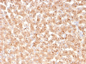 IHC staining of FFPE human liver with TTR antibody. HIER: boil tissue sections in pH 9 10mM Tris with 1mM EDTA for 20 min and allow to cool before testing.