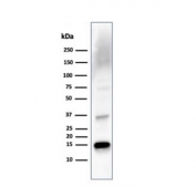 Western blot testing of human liver lysate with TTR antibody. Predicted molecular weight ~16 kDa.
