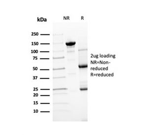 SDS-PAGE analysis of purified, BSA-free Transthyretin antibody as confirmation of integrity and purity.