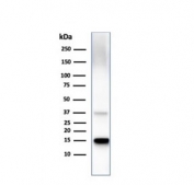 Western blot testing of human liver lysate with Transthyretin antibody. Predicted molecular weight ~16 kDa.