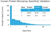 Analysis of HuProt(TM) microarray containing more than 19,000 full-length human proteins using Transthyretin antibody. These results demonstrate the foremost specificity of the TTR/4296 mAb. Z- and S- score: The Z-score represents the strength of a signal that an antibody (in combination with a fluorescently-tagged anti-IgG secondary Ab) produces when binding to a particular protein on the HuProt(TM) array. Z-scores are described in units of standard deviations (SD's) above the mean value of all signals generated on that array. If the targets on the HuProt(TM) are arranged in descending order of the Z-score, the S-score is the difference (also in units of SD's) between the Z-scores. The S-score therefore represents the relative target specificity of an Ab to its intended target.