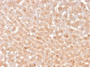 IHC staining of FFPE human liver with Transthyretin antibody. HIER: boil tissue sections in pH 9 10mM Tris with 1mM EDTA for 20 min and allow to cool before testing.