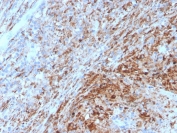 IHC staining of FFPE human lymph node with TIM3 antibody. HIER: boil tissue sections in pH 9 10mM Tris with 1mM EDTA for 20 min and allow to cool before testing.