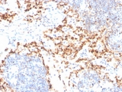 IHC staining of FFPE human tonsil with TIM3 antibody. HIER: boil tissue sections in pH 9 10mM Tris with 1mM EDTA for 20 min and allow to cool before testing.
