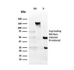 SDS-PAGE analysis of purified, BSA-free CD27 antibody (clone LPFS2/4177) as confirmation of integrity and purity.