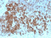 IHC staining of FFPE human tonsil with CD27 antibody (clone LPFS2/4179). HIER: boil tissue sections in pH 9 10mM Tris with 1mM EDTA for 20 min and allow to cool before testing.