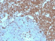 IHC staining of FFPE human tonsil with CD27 antibody (clone LPFS2/4179). HIER: boil tissue sections in pH 9 10mM Tris with 1mM EDTA for 20 min and allow to cool before testing.