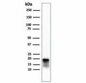 Western blot testing of human COLO-38 cell lysate with recombinant MART-1 antibody (clone MLANA/4385R). Expected molecular weight ~20 kDa with possible doublet.