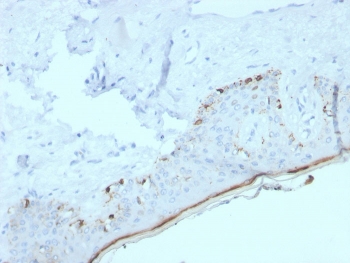 IHC staining of FFPE human skin with recombinant MART-1 antibody (clone MLANA/4385R). HIER: boil tissue sections in pH 9 10mM Tris with 1mM EDTA for 20 min and allow to cool before testing.~