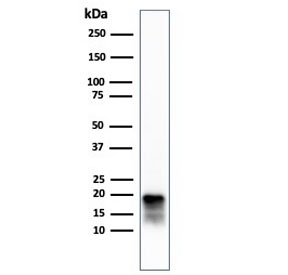 Western blot testing of human COLO-38 cell lys