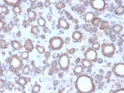 IHC staining of FFPE human thyroid with DBC2 antibody. HIER: boil tissue sections in pH 9 10mM Tris with 1mM EDTA for 20 min and allow to cool before testing.