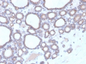 IHC staining of FFPE human thyroid with DBC2 antibody. HIER: boil tissue sections in pH 9 10mM Tris with 1mM EDTA for 20 min and allow to cool before testing.