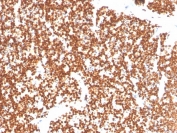 IHC staining of FFPE human thymus with NR5A1 antibody. HIER: boil tissue sections in pH 9 10mM Tris with 1mM EDTA for 20 min and allow to cool before testing.