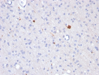 IHC staining of FFPE human brain with Beta Amyloid antibody (clone APP/3343). HIER: boil tissue sections in pH 9 10mM Tris with 1mM EDTA for 20 min and allow to cool before testing.