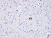 IHC staining of FFPE human brain with Beta Amyloid antibody (clone APP/3343). HIER: boil tissue sections in pH 9 10mM Tris with 1mM EDTA for 20 min and allow to cool before testing.