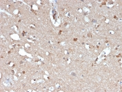IHC staining of FFPE human brain with Amyloid Beta antibody (clone APP/3345). HIER: boil tissue sections in pH 9 10mM Tris with 1mM EDTA for 20 min and allow to cool before testing.