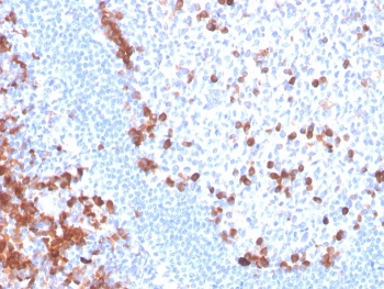 IHC staining of FFPE human tonsil with B7-H6 antibody. HIER: boil tissue sections in pH 9 10mM Tris with 1mM EDTA for 20 min and allow to cool before testing.~