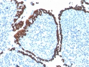IHC staining of FFPE human tonsil with recombinant Cytokeratin 5 antibody (clone KRT5/4245R). HIER: boil tissue sections in pH 9 10mM Tris with 1mM EDTA for 20 min and allow to cool before testing.