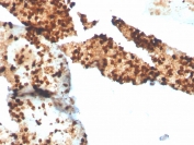 IHC staining of FFPE human spleen with recombinant S100P antibody. HIER: boil tissue sections in pH 9 10mM Tris with 1mM EDTA for 20 min and allow to cool before testing.