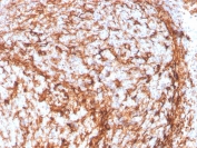 IHC staining of FFPE human tonsil with recombinant Vimentin antibody (clone VIM/4388R). HIER: boil tissue sections in pH 9 10mM Tris with 1mM EDTA for 20 min and allow to cool before testing.