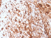 IHC staining of FFPE human tonsil with recombinant Vimentin antibody (clone VIM/4388R). HIER: boil tissue sections in pH 9 10mM Tris with 1mM EDTA for 20 min and allow to cool before testing.