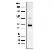 Western blot testing of human Raji cell lysate with recombinant CD38 antibody. Expected molecular weight: 34-46 kDa.