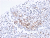 IHC staining of FFPE human tonsil with recombinant CD38 antibody. HIER: boil tissue sections in pH 9 10mM Tris with 1mM EDTA for 20 min and allow to cool before testing.