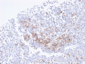 IHC staining of FFPE human tonsil with recombinant CD38 antibody. HIER: boil tissue sections in pH 9 10mM Tris with 1mM EDTA for 20 min and allow to cool before testing.