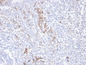 IHC staining of FFPE human tonsil with recombinant CD38 antibody. HIER: boil tissue sections in pH 9 10mM Tris with 1mM EDTA for 20 min and allow to cool before testing.