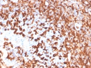 IHC staining of FFPE human tonsil with recombinant CD79a antibody (clone IGA/3939R). HIER: boil tissue sections in pH 9 10mM Tris with 1mM EDTA for 20 min and allow to cool before testing.