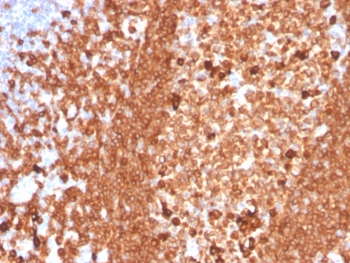 IHC staining of FFPE human tonsil with recombinant CD79a antibody (clone IGA/3939R). HIER: boil tissue sections in pH 9 10mM Tris with 1mM EDTA for 20 min and allow to cool before testing.~