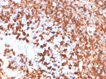 IHC staining of FFPE human tonsil with recombin