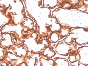 IHC staining of FFPE human placenta with recombinant EGFR antibody (clone GFR/4564R). HIER: boil tissue sections in pH 9 10mM Tris with 1mM EDTA for 20 min and allow to cool before testing.