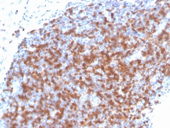 IHC staining of FFPE human tonsil with recombinant ZAP70 antibody. HIER: boil tissue sections in pH 9 10mM Tris with 1mM EDTA for 20 min and allow to cool before testing.~