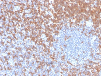 IHC staining of FFPE human tonsil with recombinant ZAP70 antibody