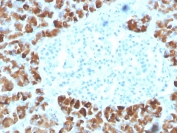 IHC staining of FFPE human pancreas with INSM2 antibody. HIER: boil tissue sections in pH 9 10mM Tris with 1mM EDTA for 20 min and allow to cool before testing.