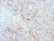 IHC staining of FFPE human tonsil with TIM-3 antibody. HIER: boil tissue sections in pH 9 10mM Tris with 1mM EDTA for 20 min and allow to cool before testing.