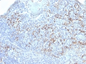 IHC staining of FFPE human tonsil with TIM3 antibody. HIER: boil tissue sections in pH 9 10mM Tris with 1mM EDTA for 20 min and allow to cool before testing.