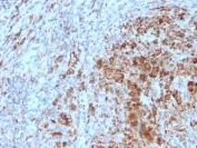 IHC staining of FFPE human lymph node with TIM3 antibody. HIER: boil tissue sections in pH 9 10mM Tris with 1mM EDTA for 20 min and allow to cool before testing.