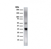 Western blot testing of human spleen lysate with TIM3 antibody. Expected molecular weight: 33-70 kDa depending on glycosylation level.