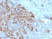 IHC staining of FFPE human lymph node with TIM3 antibody. HIER: boil tissue sections in pH 9 10mM Tris with 1mM EDTA for 20 min and allow to cool before testing.