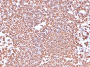IHC testing of FFPE human tonsil tissue with recombinant CD20 antibody (clone IGEL/4524R). HIER: boil tissue sections in pH6, 10mM citrate buffer, for 20 min and allow to cool before testing.