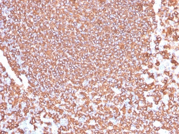 IHC testing of FFPE human tonsil tissue with recombinant CD20 antibody (clone IGEL/4524R). HIER: boil tissue sections in pH6, 10mM citrate buffer, for 20 min and allow to cool before testing.~
